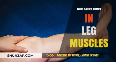 Understanding Lumps in Leg Muscles: Causes, Symptoms, and Treatment Options
