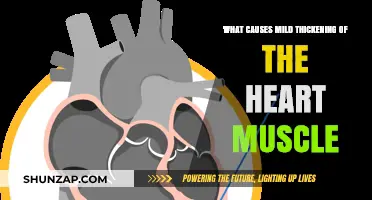 Understanding Mild Heart Muscle Thickening: Causes and Implications