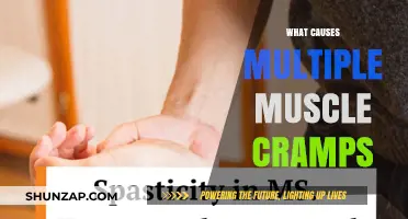 Unraveling the Mystery: Common Causes of Multiple Muscle Cramps