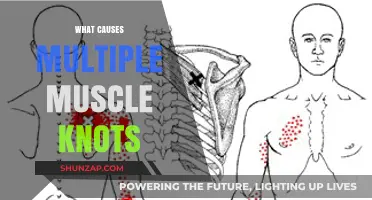 Unraveling the Mystery: What Causes Multiple Muscle Knots?
