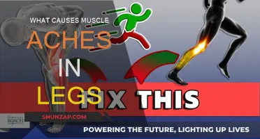 Leg Muscle Aches: What's the Cause?