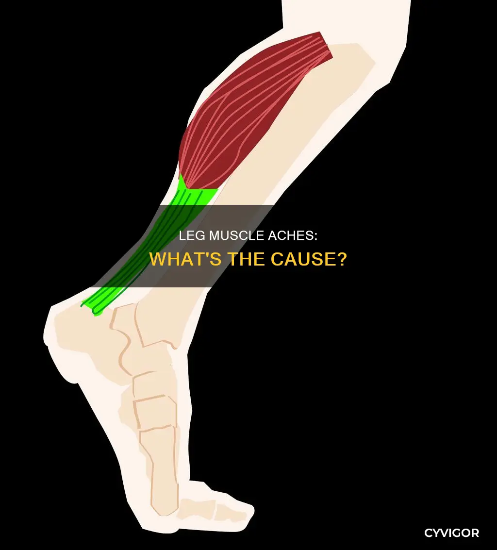 what causes muscle aches in legs