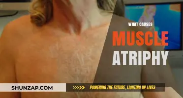 Understanding Muscle Atrophy: Causes, Prevention, and Treatment Options