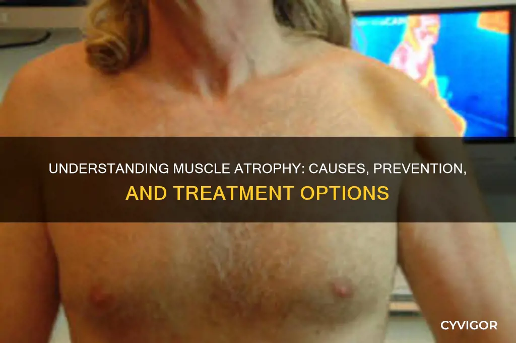what causes muscle atriphy