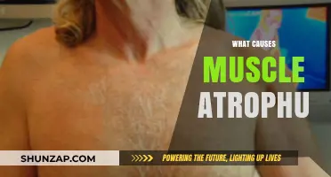 Understanding Muscle Atrophy: Causes, Prevention, and Treatment Options