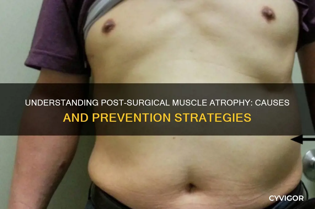 what causes muscle atrophy after surgery