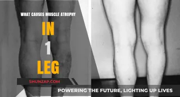 Unraveling the Mystery: Causes of One-Legged Muscle Atrophy Explained