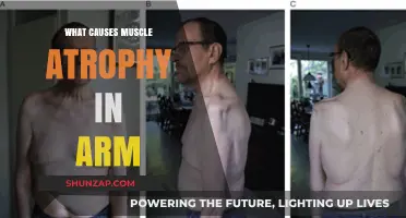 Understanding Muscle Atrophy: Causes of Arm Weakness and Shrinking