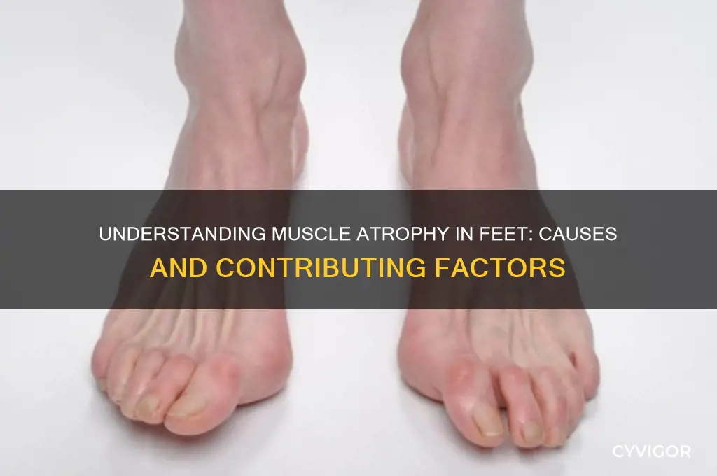 what causes muscle atrophy in feet