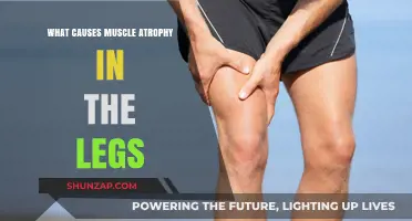 Understanding Muscle Atrophy: Causes of Leg Weakness and Shrinking
