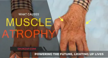 Understanding Muscle Atrophy: Causes and Triggers