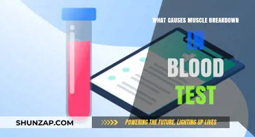 Understanding Muscle Breakdown: Causes Revealed in Blood Test Results