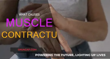 Understanding Muscle Contractures: Causes and Triggers