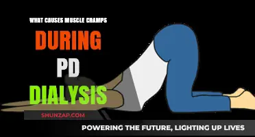 Understanding Muscle Cramps During PD Dialysis: Causes and Prevention