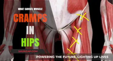 Understanding Hip Muscle Cramps: Causes and Prevention Strategies