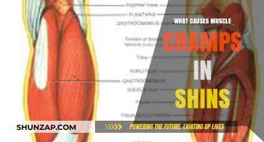 Understanding Shin Muscle Cramps: Causes and Prevention Strategies