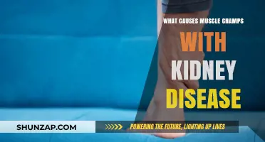 Understanding Muscle Cramps in Kidney Disease: Causes and Solutions