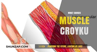 Understanding Muscle Croykú: Causes, Symptoms, and Effective Prevention Strategies