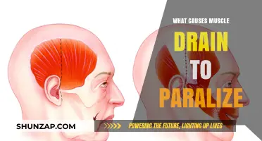 Muscle Drain and Paralysis: Uncovering the Causes and Mechanisms