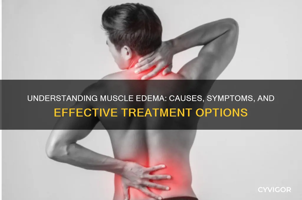 what causes muscle edema