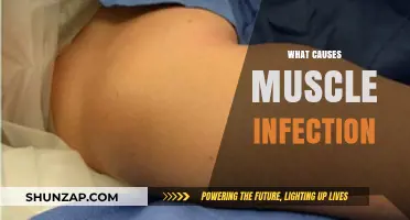 Understanding Muscle Infections: Causes, Risks, and Prevention Strategies