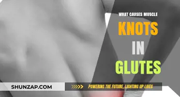 Understanding Glute Muscle Knots: Causes and Prevention Strategies