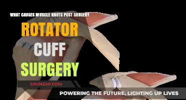 Post-Surgery Rotator Cuff: Understanding Muscle Knot Causes and Relief