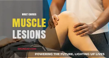 Understanding Muscle Lesions: Causes, Risk Factors, and Prevention Strategies