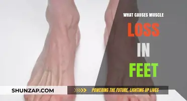 Understanding Muscle Loss in Feet: Causes and Contributing Factors