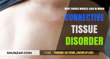 Understanding Muscle Loss in Mixed Connective Tissue Disorder: Causes Explained