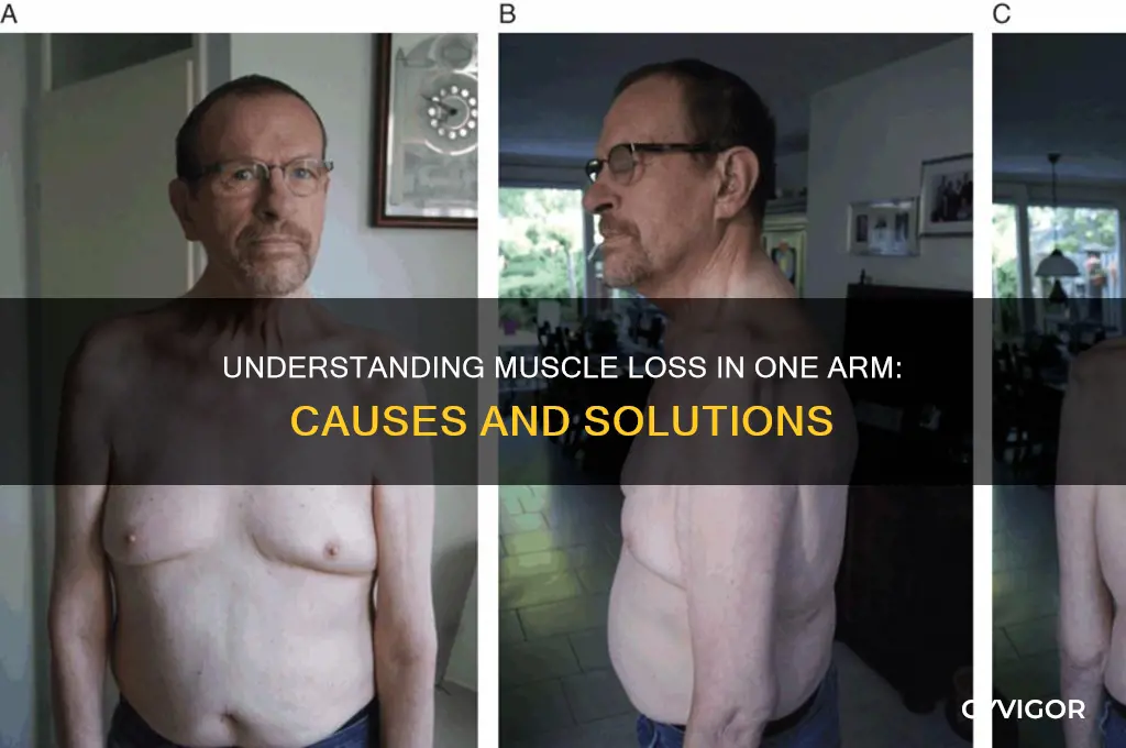 what causes muscle loss in one arm