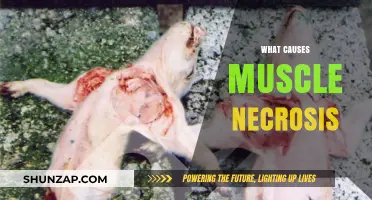 Understanding Muscle Necrosis: Causes, Risk Factors, and Prevention Strategies