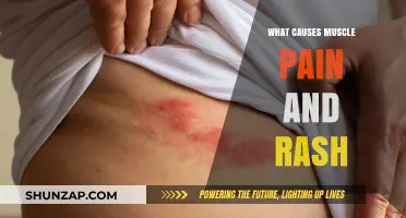 Understanding Muscle Pain and Rash: Causes, Symptoms, and Treatment Options
