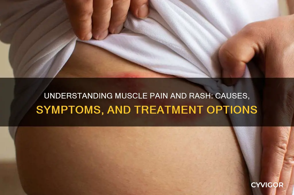 what causes muscle pain and rash