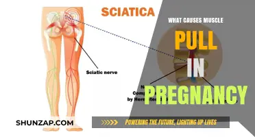 Pregnancy Muscle Pulls: Understanding Causes and Prevention Tips