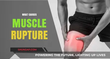 Understanding Muscle Rupture: Causes, Risk Factors, and Prevention Tips
