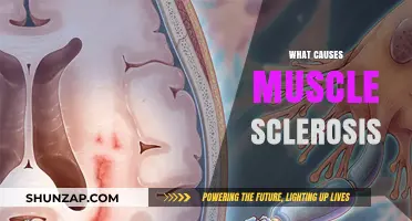 Understanding Muscle Sclerosis: Causes, Risk Factors, and Early Detection