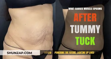 Understanding Post-Tummy Tuck Muscle Spasms: Causes and Relief Strategies