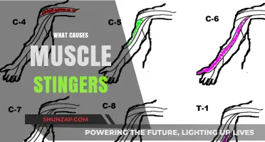 Understanding Muscle Stingers: Causes, Symptoms, and Prevention Tips
