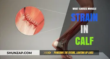 Understanding Calf Muscle Strain: Common Causes and Prevention Tips