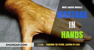 Understanding Hand Muscle Atrophy: Causes and Prevention Strategies