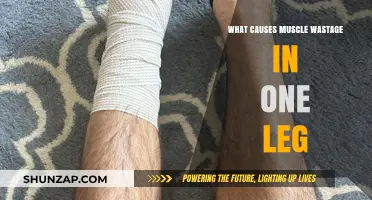 Understanding Muscle Atrophy: Causes of One-Legged Muscle Wastage