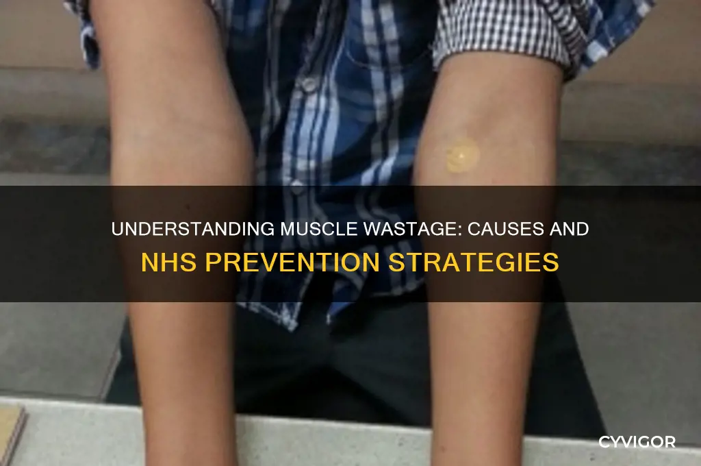 what causes muscle wastage nhs