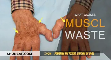 Understanding Muscle Wasting: Causes and Triggers