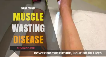 Understanding Muscle Wasting Disease: Causes, Symptoms, and Prevention Tips