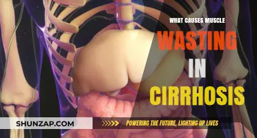 Understanding Muscle Wasting in Cirrhosis: Causes and Mechanisms Explained