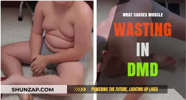 Understanding Muscle Wasting in Duchenne Muscular Dystrophy: Causes Explained