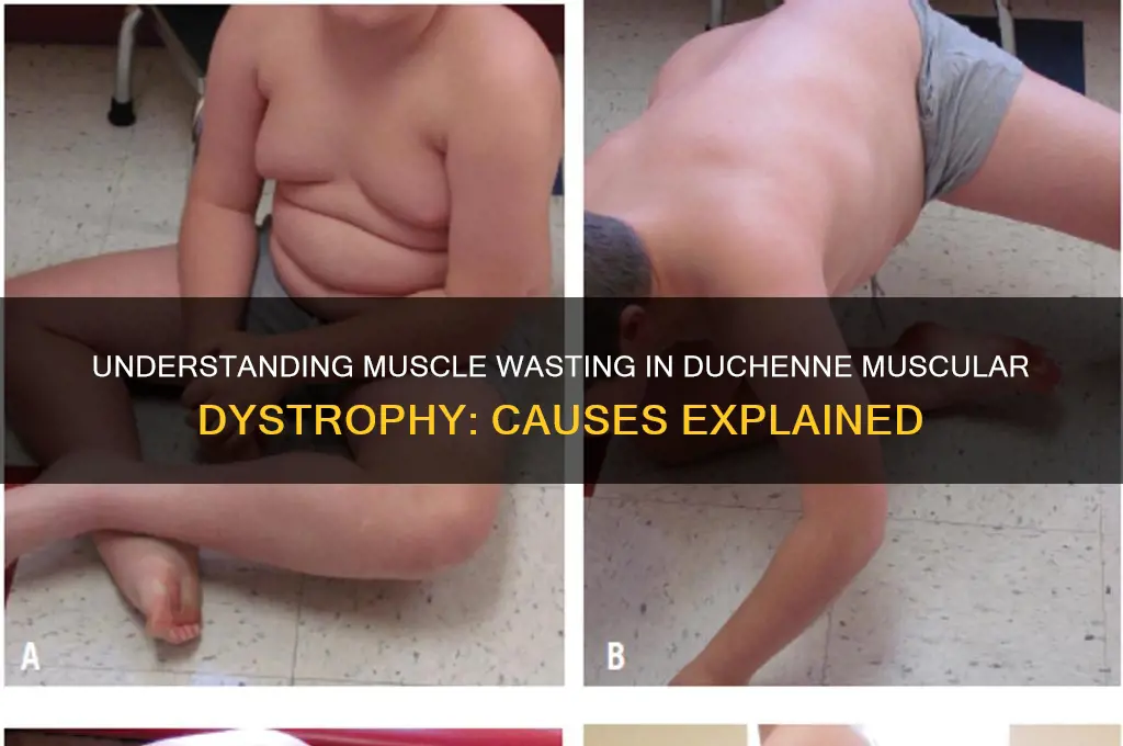 what causes muscle wasting in dmd