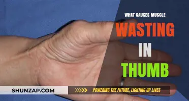 Understanding Thumb Muscle Wasting: Causes, Symptoms, and Treatment Options