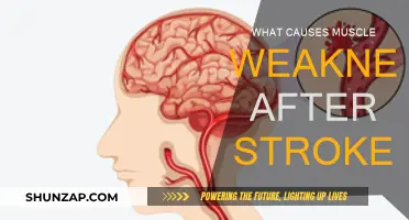 Understanding Post-Stroke Muscle Weakness